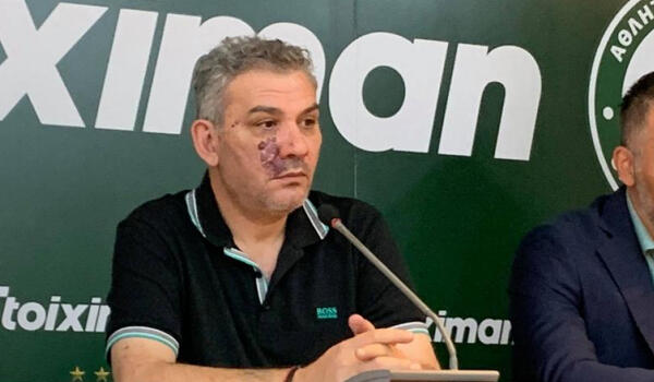 Παραίτηση Γρηγόρη: «Δεν είναι επιτροπή, είναι one man show. Ποιος ελέγχει τους ελεγκτές;» image