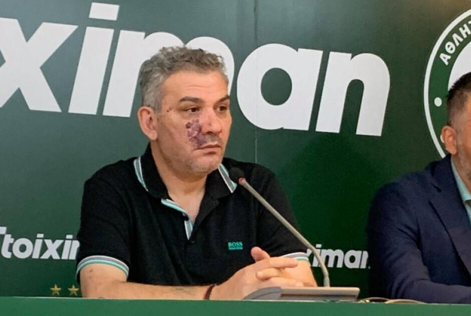 Παραίτηση Γρηγόρη: «Δεν είναι επιτροπή, είναι one man show. Ποιος ελέγχει τους ελεγκτές;» thumb