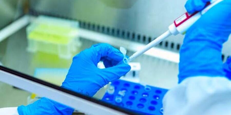 Ένας θάνατος και 21 νέα κρούσματα κορονοϊού σήμερα στην Κύπρο thumb