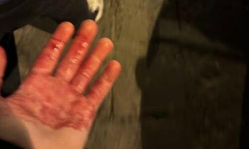 Χαμός πριν το Νάπολι-Τσέλσι: Οπαδοί των «παρτενοπέι» μαχαίρωσαν δύο Άγγλους thumb