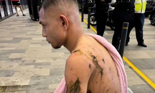 Στην εντατική διεθνής άσος της Μαλαισίας μετά από επίθεση με καυστικό υγρό thumb