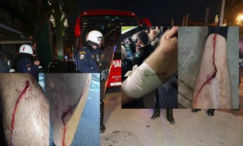 Προσοχή σκληρές εικόνες: Σοβαρές καταγγελίες για αστυνομική βία στη Λεωφόρο! thumb