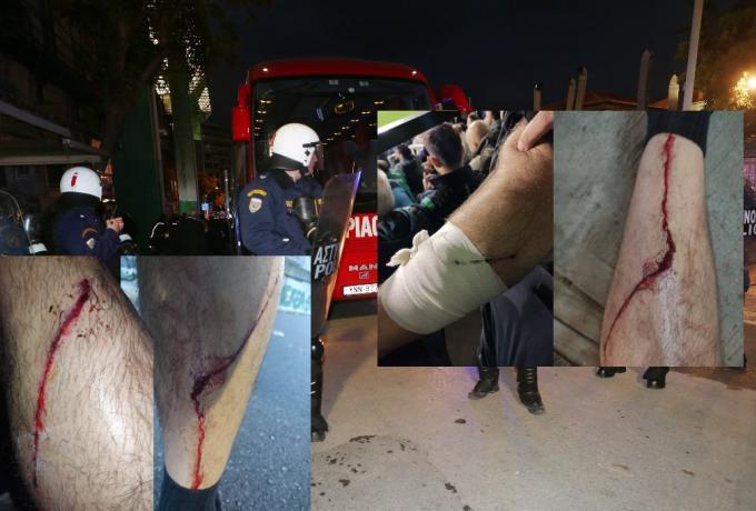 Προσοχή σκληρές εικόνες: Σοβαρές καταγγελίες για αστυνομική βία στη Λεωφόρο! thumb
