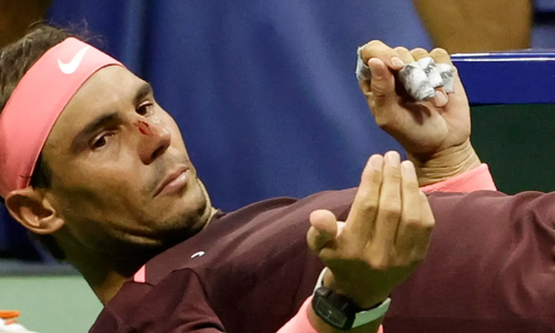 US Open: Ο Ναδάλ... αυτοτραματίσθηκε, αλλά προκρίθηκε thumb